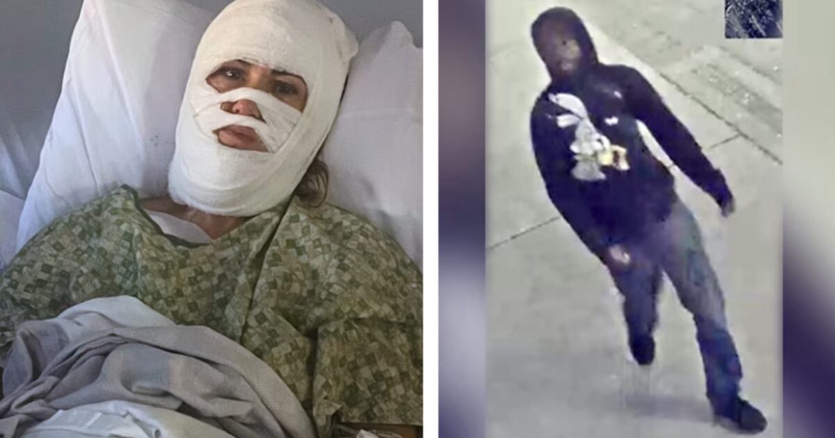Georgia Acid Attack Victim Lashes Out at Savannah Mayor and Police For Withholding Video Evidence, Suggesting She Personally Knew Suspect