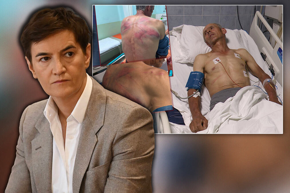 "OVO JE NENAD RAŠKOVIĆ KOG JE U KUĆI PRETUKLA TZV. KOSOVSKA POLICIJA" Brnabić najoštrije osudila prebijanje Srbina na KiM: Nikada nećemo odustati (VIDEO)