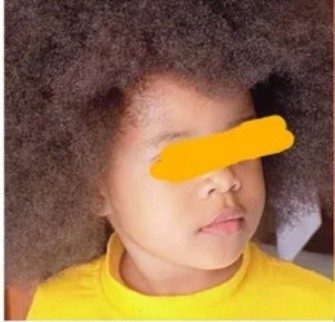 Cameroun : enquêtes ouvertes après suspicion de viol sur une élève de deux ans à Odza