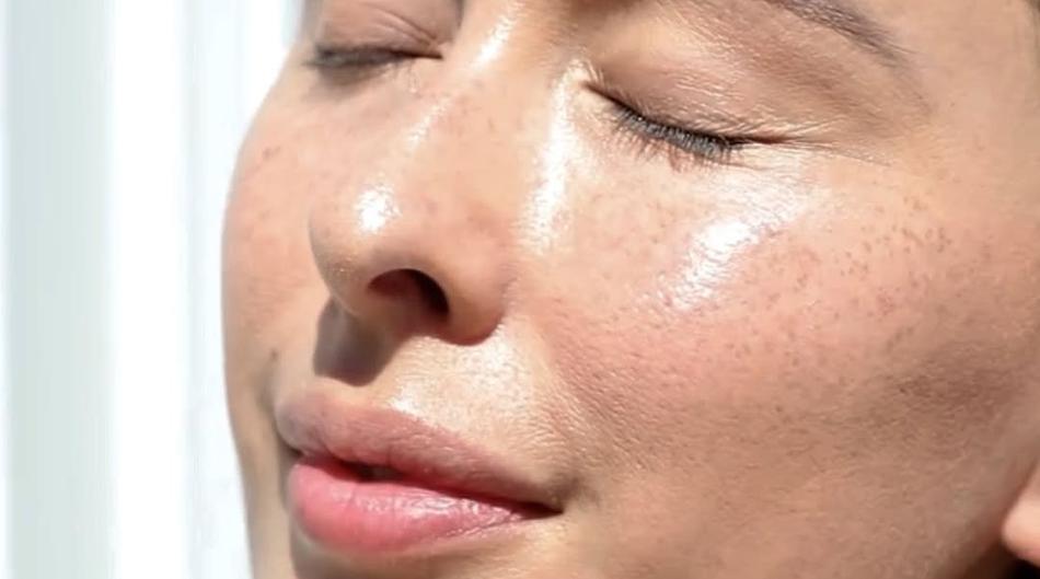 Kako koži dati volumen i svjež izgled bez filera? Dermatolozi priznaju koristi ovih 8 metoda